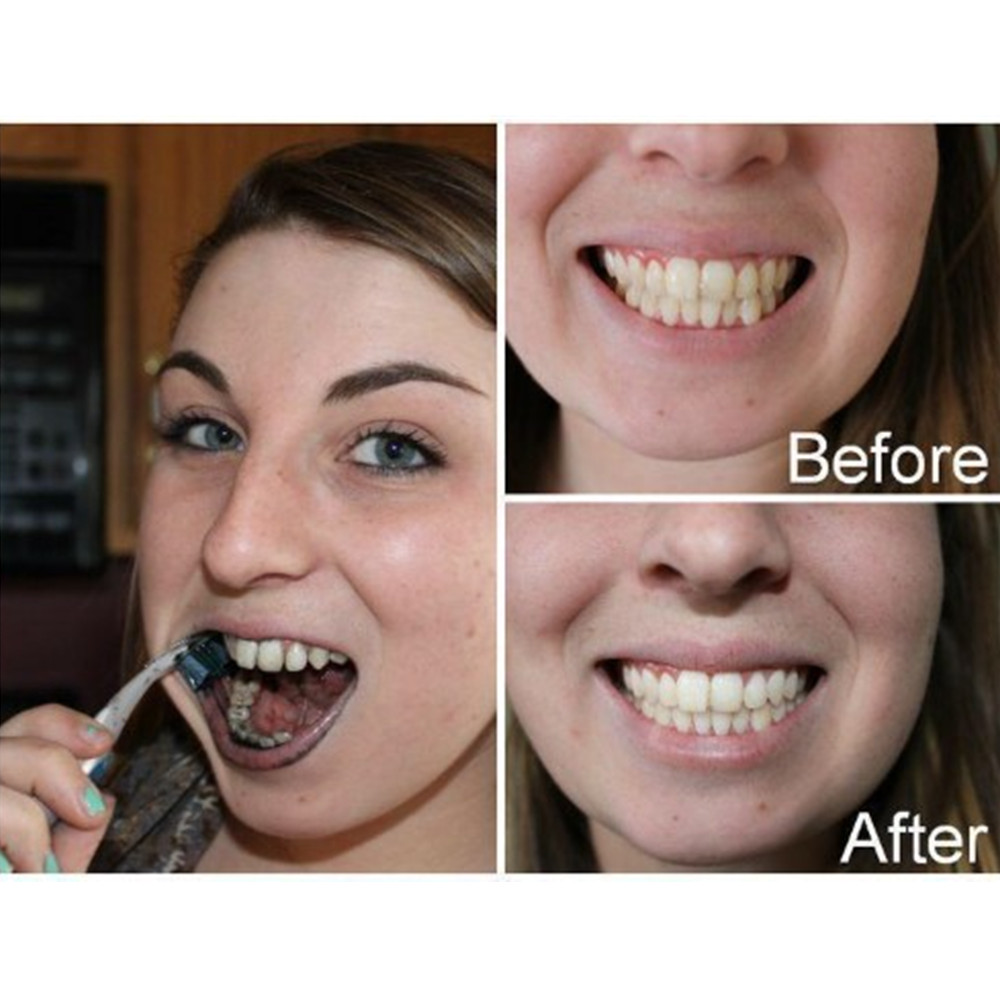 الخيزران الفحم الأسنان الأسنان - مراجعة Teeth Whitening Near Me وسعره