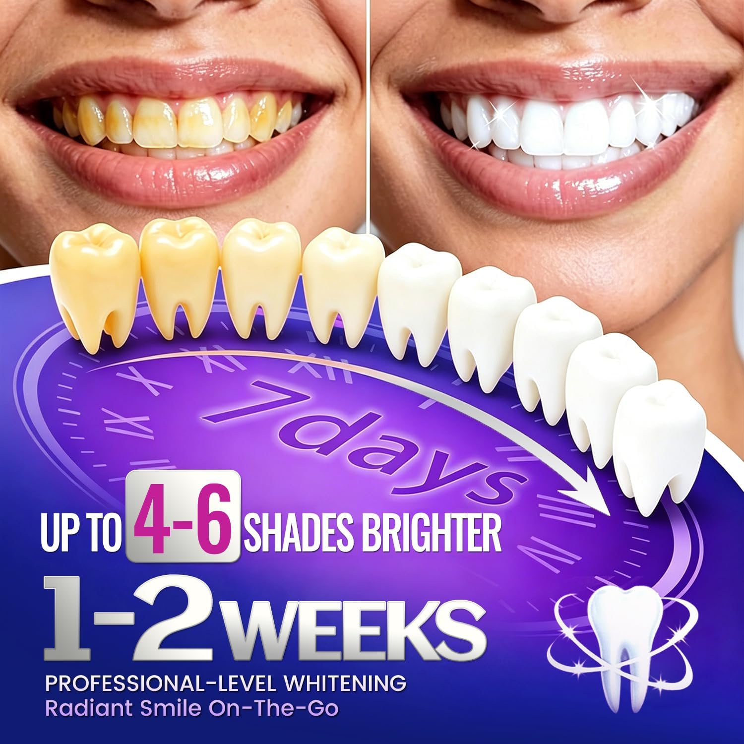 7 أزواج من شرائط تبييض الأسنان - مراجعة Teeth Whitening Retainer وسعره