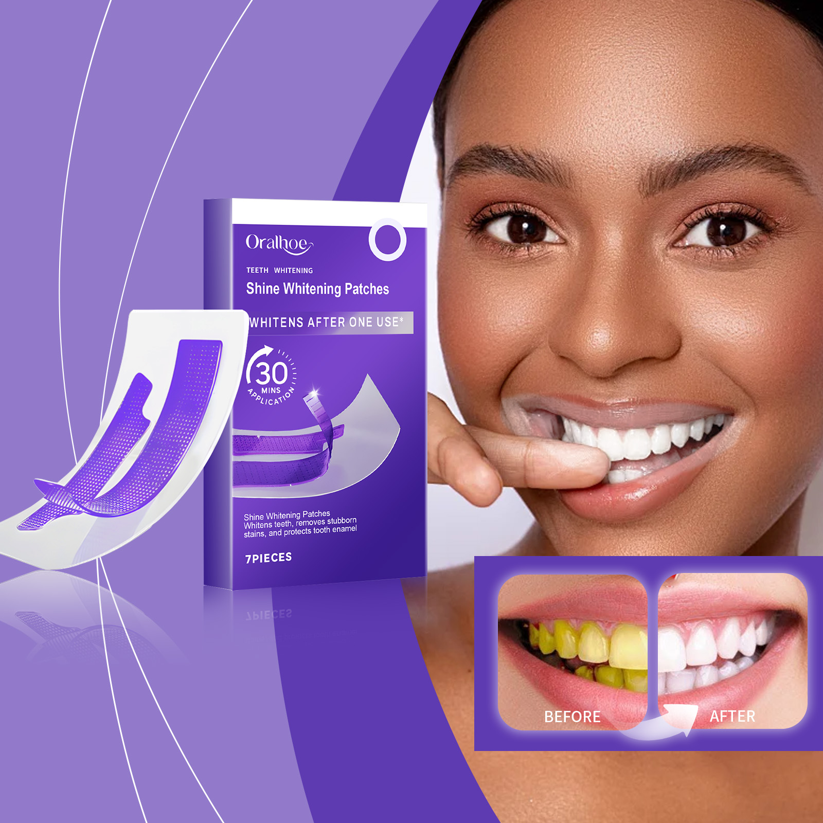 شرائط تبييض الأسنان باللون الأ - مراجعة Teeth Whitening Retainer وسعره