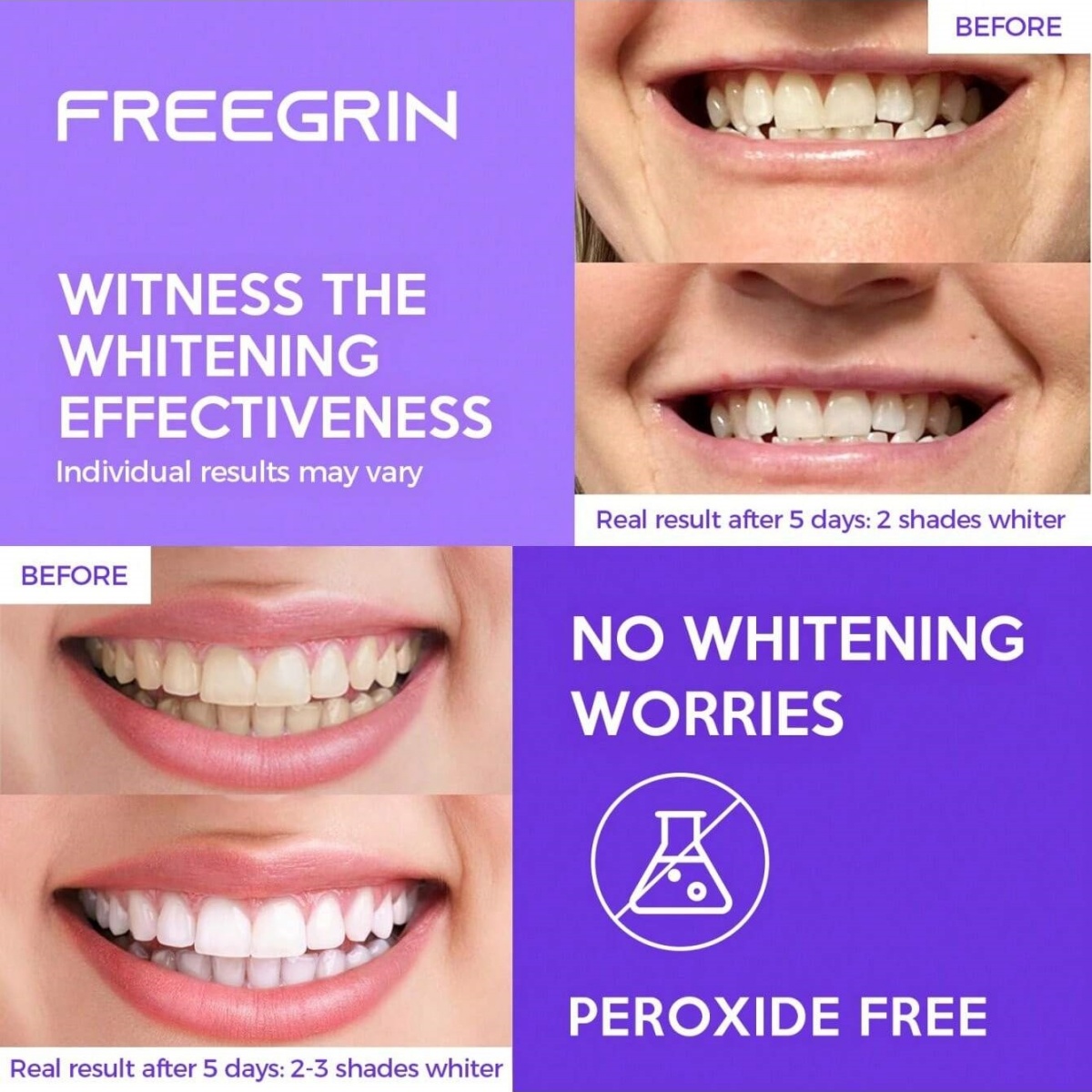 ديلوكس تبييض الأسنان ملصقات 7/ - مراجعة Teeth Whitening Near Me وسعره